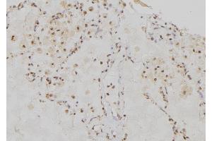 ABIN6276555 at 1/100 staining Human lung tissue by IHC-P. (RRM1 anticorps  (Internal Region))