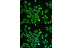Immunofluorescence (IF) image for anti-SMAD, Mothers Against DPP Homolog 1 (SMAD1) (AA 20-240) antibody (ABIN3021439) (SMAD1 anticorps  (AA 20-240))
