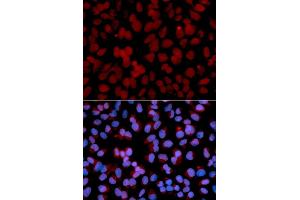 Immunofluorescence analysis of U2OS cells using TNF antibody (ABIN6128830, ABIN6149292, ABIN6149293 and ABIN6217713). (TNFAIP3 anticorps  (AA 1-190))