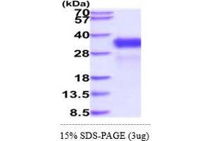 SDS-PAGE (SDS) image for Retinoic Acid Early Transcript 1E (RAET1E) (AA 31-225) protein (His tag) (ABIN6388090)