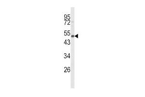 Western blot analysis of CYP24A1 Antibody (C-term) (ABIN652590 and ABIN2842395) in mouse spleen tissue lysates (35 μg/lane).