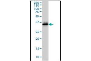 Western Blotting (WB) image for anti-Cyclin-Dependent Kinase 6 (CDK6) antibody (ABIN781963)