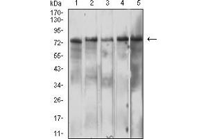 Western blot analysis using IL10RB mouse mAb against Hela (1), Jurkat (2), Ramos (3), Raji (4), and C6 (5) cell lysate.