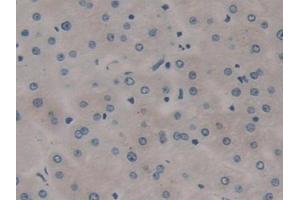 Detection of RSPO3 in Human Liver Tissue using Polyclonal Antibody to R-Spondin 3 (RSPO3)