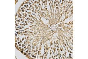 Immunohistochemistry (IHC) image for anti-X-Ray Repair Complementing Defective Repair in Chinese Hamster Cells 3 (XRCC3) (AA 62-346) antibody (ABIN3023006)