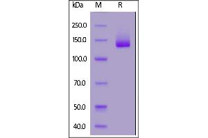 Human NCAM-1, Fc Tag on  under reducing (R) condition.