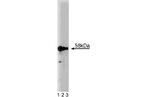 Western blot analysis of Karyopherin alpha on a HeLa cell lysate (Human cervical epitheloid carcinoma, ATCC CCL-2. (KPNA2 anticorps  (AA 254-497))