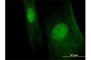 Immunofluorescence of purified MaxPab antibody to MAGEB6 on Hs 181. (MAGEB6 anticorps  (AA 1-407))