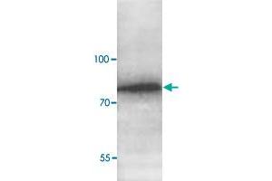 Western blot analysis of human fetal liver lysate with ABCG8 polyclonal antibody  at 1 : 1000 dilution. (ABCG8 anticorps  (C-Term))