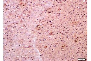 Paraformaldehyde-fixed, paraffin embedded mouse brain tissue, Antigen retrieval by boiling in sodium citrate buffer(pH6) for 15min, Block endogenous peroxidase by 3% hydrogen peroxide for 30 minutes, Blocking buffer (normal goat serum) at 37°C for 20min, Antibody incubation with Rabbit Anti-RANK Polyclonal Antibody, Unconjugated  at 1:400 overnight at 4°C, followed by a conjugated secondary and DAB staining