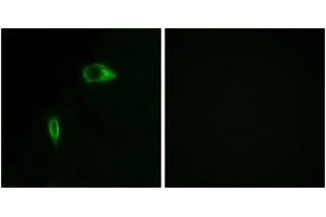 Immunofluorescence analysis of HeLa cells, using Collagen XIV alpha1 Antibody. (COL14A1 anticorps  (AA 71-120))