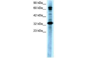 WB Suggested Anti-MAP3K7IP2  Antibody Titration: 0.