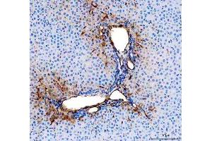 IHC analysis of CD31/Pecam1 using anti-CD31/Pecam1 antibody (ABIN7601662). (CD31 anticorps  (AA 41-258))