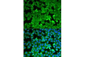 Immunofluorescence analysis of A549 cells using ASNS antibody.