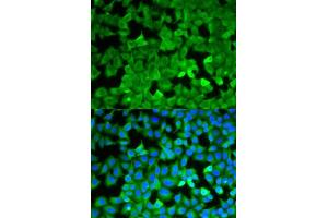 Immunofluorescence analysis of A549 cells using ASNS antibody. (Asparagine Synthetase anticorps  (AA 262-561))