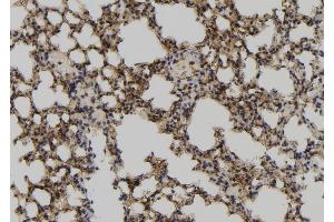 ABIN6267136 at 1/100 staining Mouse lung tissue by IHC-P.
