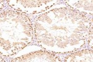 Immunohistochemistry analysis of paraffin-embedded mouse testis using,ZSCAN20 (ABIN7076252) at dilution of 1: 3000 (ZSCAN20 anticorps)
