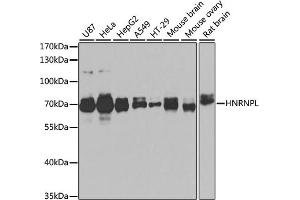 Western blot analysis of extracts of various cell lines, using HNRNPL antibody (ABIN6128048, ABIN6141915, ABIN6141917 and ABIN6216076) at 1:1000 dilution. (HNRNPL anticorps  (AA 282-589))