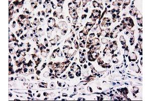 Immunohistochemistry (IHC) image for anti-Striatin Interacting Protein 1 (STRIP1) antibody (ABIN1498204) (STRIP1 anticorps)