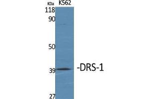 Western Blot (WB) analysis of specific cells using DRS-1 Polyclonal Antibody.