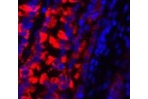 Immunofluorescence analysis of Rat lung tissue using MMP2 Polyclonal Antibody at dilution of 1:200.