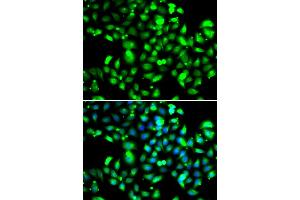 Immunofluorescence analysis of U2OS cells using GBP1 antibody. (GBP1 anticorps)