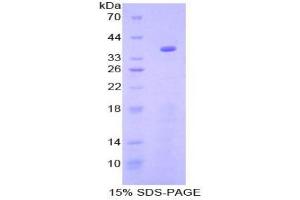 SDS-PAGE analysis of Mouse GSK3a Protein. (GSK3 alpha Protéine)