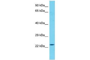Host: Rabbit Target Name: CXorf56 Sample Type: Fetal Heart lysates Antibody Dilution: 1. (CXorf56 anticorps  (C-Term))