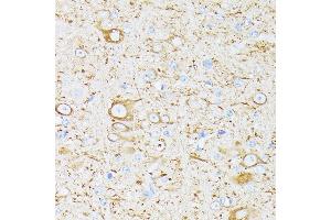Immunohistochemistry of paraffin-embedded mouse brain using βIII-Tubulin/β3-Tubulin  at dilution of 100 (40x lens). (TUBB3 anticorps)