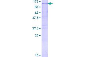 Image no. 1 for Mars (MARS) (AA 1-900) protein (GST tag) (ABIN1310403)