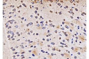 IHC analysis of PMPCA/INPP5 using anti-PMPCA/INPP5 antibody (ABIN7602722). (PMPCA anticorps  (AA 99-525))