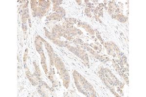anti-DEAD (Asp-Glu-Ala-Asp) Box Polypeptide 6 (DDX6) (AA 425-483) antibody
