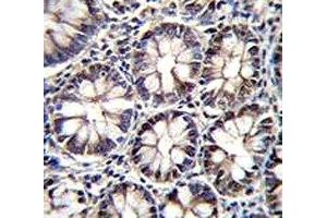 CTBP2 antibody immunohistochemistry analysis in formalin fixed and paraffin embedded human rectum tissue.