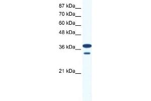 Human Jurkat; WB Suggested Anti-LHX3 Antibody Titration: 0. (LHX3 anticorps  (Middle Region))