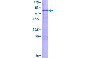 Image no. 1 for Transcription Factor AP-2 gamma (Activating Enhancer Binding Protein 2 Gamma) (TFAP2C) (AA 1-450) protein (GST tag) (ABIN1322529)