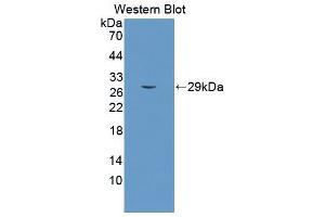 Western blot analysis of the recombinant protein. (PSMA anticorps  (AA 536-752))