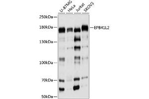 Western blot analysis of extracts of various cell lines, using EPB41L2 antibody (ABIN6131606, ABIN6140199, ABIN6140200 and ABIN6224888) at 1:1000 dilution. (EPB41L2 anticorps  (AA 1-210))