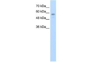 WB Suggested Anti-C20orf18 Antibody Titration:  1. (RBCK1 anticorps  (Middle Region))
