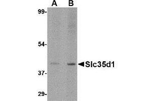 Western Blotting (WB) image for anti-Solute Carrier Family 35 (UDP-Glucuronic Acid/UDP-N-Acetylgalactosamine Dual Transporter), Member D1 (SLC35D1) (N-Term) antibody (ABIN1031577) (SLC35D1 anticorps  (N-Term))