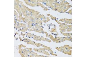 Immunohistochemistry of paraffin-embedded mouse heart using UCN2 antibody (ABIN5973879) at dilution of 1/100 (40x lens). (Urocortin 2 anticorps)