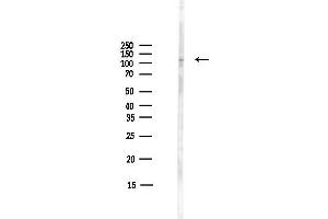 anti-Interferon Induced with Helicase C Domain 1 (IFIH1) (C-Term) antibody