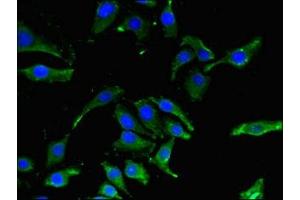 Immunofluorescent analysis of A549 cells using ABIN7146741 at dilution of 1:100 and Alexa Fluor 488-congugated AffiniPure Goat Anti-Rabbit IgG(H+L)