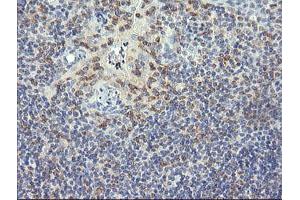 Image no. 5 for anti-Ring Finger Protein 39 (RNF39) antibody (ABIN1500723)