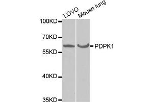 Western blot analysis of extracts of various cell lines, using PDPK1 antibody (ABIN5970826) at 1/1000 dilution.