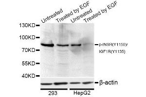 Western blot analysis of extracts of 293 and HepG2 cells, using Phospho-INSR-Y1150/IGF1R-Y1135 antibody (ABIN5969901) at 1/1000 dilution. (Insulin Receptor anticorps  (pTyr1135, pTyr1150))