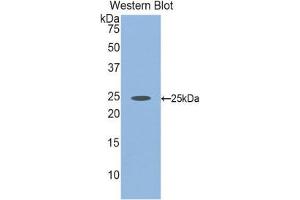 Western Blotting (WB) image for anti-Fibulin 2 (FBLN2) (AA 1013-1221) antibody (ABIN1858811) (FBLN2 anticorps  (AA 1013-1221))