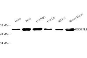 Western blot analysis of OSGEPL1 (ABIN7074934) at dilution of 1: 2000 (OSGEPL1 anticorps)