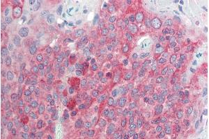 ABIN571264 (5µg/ml) staining of paraffin embedded Human Tonsil.