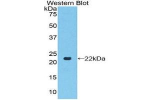 Western Blotting (WB) image for anti-Toll-Like Receptor 7 (TLR7) (AA 887-1036) antibody (ABIN1860776) (TLR7 anticorps  (AA 887-1036))