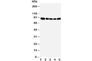 Western blot testing of OSBP antibody and Lane 1:  rat kidney;  2: (r) spleen;  3: (r) lung;  4: human HeLa;  5: (h) A549 cell lysate (OSBP anticorps  (Middle Region))